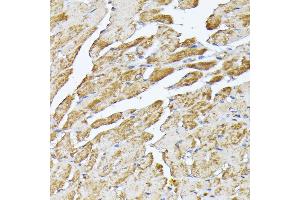 Immunohistochemistry of paraffin-embedded mouse heart using SLC25 antibody (ABIN7270430) at dilution of 1:100 (40x lens). (SLC25A5 Antikörper  (AA 150-250))