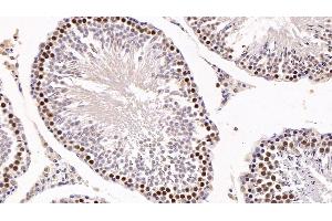 Detection of KPNa2 in Rat Testis Tissue using Polyclonal Antibody to Karyopherin Alpha 2 (KPNa2) (KPNA2 Antikörper  (AA 157-412))