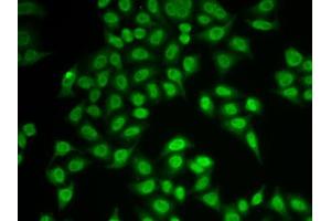Immunofluorescence analysis of MCF-7 cell using PSMB9 antibody. (PSMB9 Antikörper  (AA 1-219))