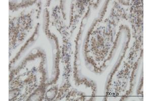 Immunoperoxidase of monoclonal antibody to SP110 on formalin-fixed paraffin-embedded human small Intestine. (SP110 Antikörper  (AA 271-380))