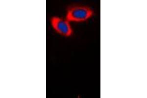 Immunofluorescent analysis of CD3d staining in Jurkat cells. (CD3D Antikörper  (Center))