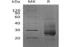 Western Blotting (WB) image for Hepatitis A Virus Cellular Receptor 2 (TIM 3) protein (His tag) (ABIN7320955)