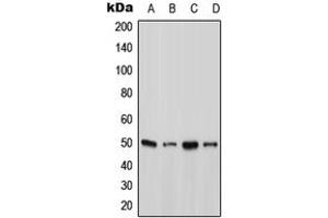 Western blot analysis of Ataxin 10 expression in A431 (A), HepG2 (B), SP2/0 (C), H9C2 (D) whole cell lysates. (Ataxin 10 Antikörper  (N-Term))