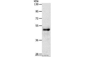 Western blot analysis of Human  fetal brain tissue, using SOX8 Polyclonal Antibody at dilution of 1:500 (SOX8 Antikörper)