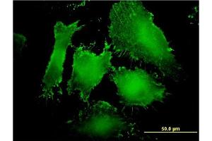 Immunofluorescence of monoclonal antibody to MAGI1 on HeLa cell. (MAGI1 Antikörper  (AA 761-859))