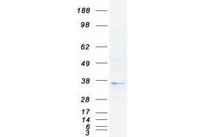 Western Blotting (WB) image for Major Histocompatibility Complex, Class II, DO beta (HLA-DOB) protein (Myc-DYKDDDDK Tag) (ABIN2722840)