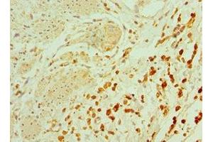 Immunohistochemistry of paraffin-embedded human epityphlon tissue using ABIN7164900 at dilution of 1:100 (TAC1 Antikörper  (AA 1-129))