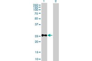 Western Blot analysis of SHOX expression in transfected 293T cell line by SHOX MaxPab polyclonal antibody.