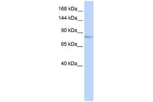 WB Suggested Anti-EVI1 Antibody Titration: 0. (MECOM Antikörper  (N-Term))