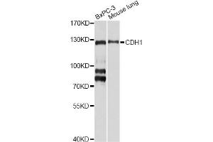 Western blot analysis of extracts of various cell lines, using CDH1 antibody (ABIN5971558) at 1/1000 dilution. (E-cadherin Antikörper)