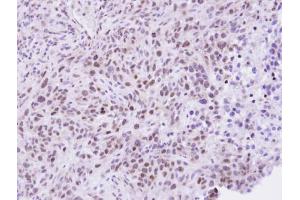 Immunohistochemistry (IHC) image for anti-Zinc Fingers and Homeoboxes 2 (ZHX2) (C-Term) antibody (ABIN2856852)