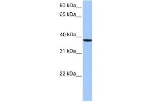CK2 alpha antibody used at 1 ug/ml to detect target protein. (CSNK2A1/CK II alpha Antikörper  (C-Term))