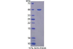 Image no. 1 for Persephin (PSPN) (AA 29-156) protein (His tag,GST tag) (ABIN6236838)