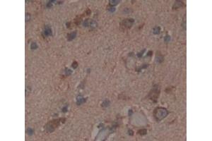 IHC-P analysis of Human Tissue, with DAB staining. (NMDAR2A Antikörper  (AA 31-555))