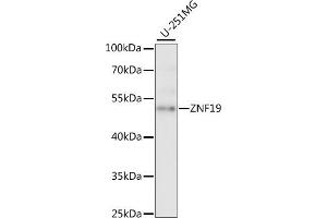 Western blot analysis of extracts of U-251MG cells, using ZNF19 antibody (ABIN7271464) at 1:1000 dilution. (ZNF19 Antikörper  (AA 1-180))