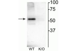 Western blot of mouse habenula lysate showing specific immunolabeling of the ~52 kDa nAChRβ4 protein. (CHRNB4 Antikörper  (Cytoplasmic Loop))
