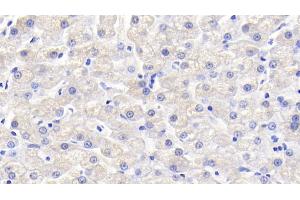 Detection of VEGFB in Canine Liver Tissue using Polyclonal Antibody to Vascular Endothelial Growth Factor B (VEGFB)