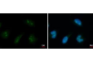 ICC/IF Image DDX18 antibody detects DDX18 protein at nucleolus by immunofluorescent analysis. (DDX18 Antikörper  (Center))