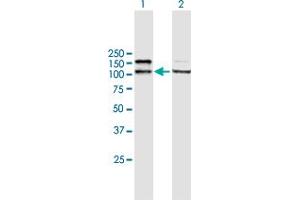 Western Blotting (WB) image for anti-Adenosine Deaminase, RNA-Specific (ADAR) (AA 1-1226) antibody (ABIN513112)