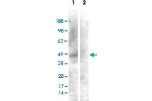 HEK293 overexpressing CNR1 and probed with CNR1 polyclonal antibody  (mock transfection in second lane), tested by Origene. (CNR1 Antikörper)