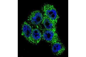 Immunofluorescence (IF) image for anti-Transient Receptor Potential Cation Channel, Subfamily M, Member 8 (TRPM8) antibody (ABIN2996363) (TRPM8 Antikörper)