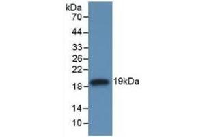 Detection of Recombinant IL18BP, Human using Monoclonal Antibody to Interleukin 18 Binding Protein (IL18BP) (IL18BP Antikörper  (AA 31-194))