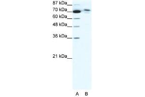 C14ORF101 antibody used at 5 ug/ml to detect target protein. (C14orf101 Antikörper  (N-Term))