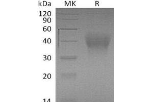 Western Blotting (WB) image for Hepatitis A Virus Cellular Receptor 2 (TIM 3) (AA 20-191) protein (His tag) (ABIN7320773)