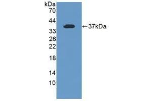 Detection of Recombinant TFR2, Human using Polyclonal Antibody to Transferrin Receptor 2 (TFR2) (Transferrin Receptor 2 Antikörper  (AA 493-784))