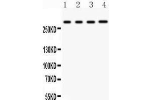 Anti- IP3 receptor antibody, Western blotting All lanes: Anti IP3 receptor  at 0.