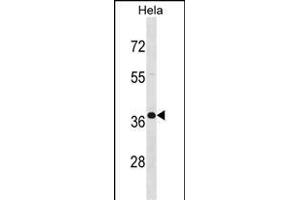 BPN1 Antibody (C-term) (ABIN1536983 and ABIN2848520) western blot analysis in Hela cell line lysates (35 μg/lane). (PABPN1 Antikörper  (C-Term))