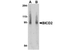 Western blot analysis of BICD2 in A549 cell lysate with AP30146PU-N BICD2 antibody at (A) 1 and (B) 2 μg/ml. (BICD2 Antikörper  (Center))