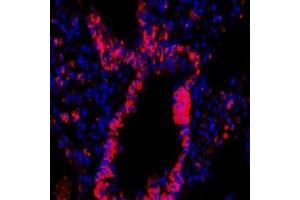 Immunofluorescent analysis of paraformaldehyde-fixed rat lung using,CD63 (ABIN7073400) at dilution of 1: 1500 (CD63 Antikörper)