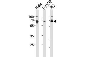Western Blotting (WB) image for anti-Protein Kinase, AMP-Activated, gamma 3 Non-Catalytic Subunit (PRKAG3) antibody (ABIN2999063) (PRKAG3 Antikörper)