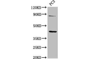 Western Blot Positive WB detected in: PC-3 whole cell lysate All lanes: TNFRSF19 antibody at 2. (TNFRSF19 Antikörper  (AA 276-415))