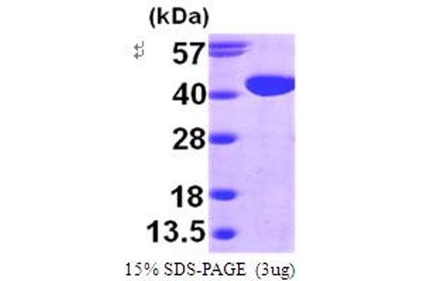 GALM Protein (AA 1-342) (His tag)