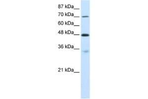 Western Blotting (WB) image for anti-Cysteinyl-tRNA Synthetase (CARS) antibody (ABIN2462085) (CARS Antikörper)