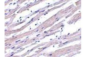 Immunohistochemistry of Apaf1 in human heart tissue with Apaf1 antibody at 1 μg/ml. (APAF1 Antikörper  (N-Term))
