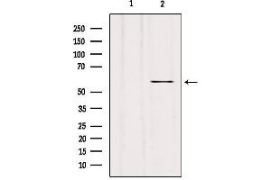 Western blot analysis of extracts from hybridoma cells, using RIPK3 Antibody. (RIPK3 Antikörper)
