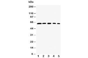 Western blot testing of RelB antibody and Lane 1:  rat testis (RELB Antikörper  (AA 393-413))