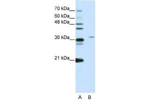 WB Suggested Anti-SART3 Antibody Titration:  2. (SART3 Antikörper  (N-Term))