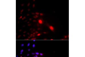 Immunofluorescence analysis of U2OS cells using DDB2 Polyclonal Antibody (DDB2 Antikörper)