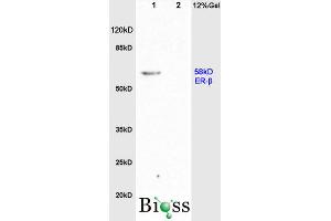 L1 rat brain, L2 rat colon lysates probed (ABIN725855) at 1:200 in 4 °C. (Estrogen Receptor alpha + beta (AA 201-300) Antikörper)