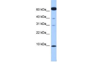 WB Suggested Anti-DYNLL2 Antibody Titration: 0. (DYNLL2 Antikörper  (N-Term))