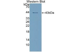 Detection of Recombinant AMY1, Human using Polyclonal Antibody to Salivary Alpha Amylase (AMY1A) (Salivary Amylase alpha (AA 15-511) Antikörper)