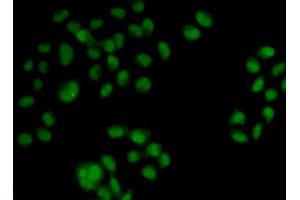Immunofluorescence analysis of HeLa cells using OAS1 antibody (ABIN5971361). (OAS1 Antikörper)