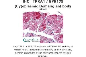 Image no. 1 for anti-Transmembrane Protein, Adipocyte Asscociated 1 (TPRA1) (2nd Cytoplasmic Domain) antibody (ABIN1740234) (GPR175 Antikörper  (2nd Cytoplasmic Domain))