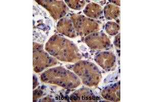 ASPH Antibody (Center) immunohistochemistry analysis in formalin fixed and paraffin embedded human stomach tissue followed by peroxidase conjugation of the secondary antibody and DAB staining.