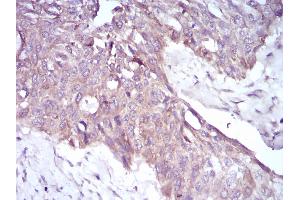 Fig. (PKHD1 Antikörper  (AA 3878-4060))