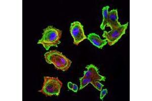 Immunofluorescence analysis of GC7901 cells using CDK5 mouse mAb (green). (CDK5 Antikörper)